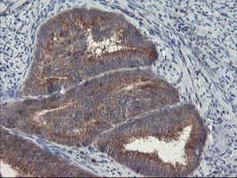 m08073 1 anti pfdn3 vbp1 mouse monoclonal antibody clone id oti1a5 ihc testing 6