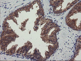 m08073 1 anti pfdn3 vbp1 mouse monoclonal antibody clone id oti1a5 ihc testing 7