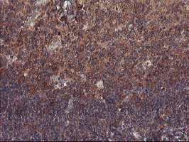 m08073 1 anti pfdn3 vbp1 mouse monoclonal antibody clone id oti1a5 ihc testing 8
