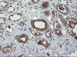 m08073 1 anti pfdn3 vbp1 mouse monoclonal antibody clone id oti1a5 ihc testing 9