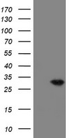 HEK293T cells were transfected with the pCMV6-ENTRY control (Left lane) or pCMV6-ENTRY VBP1 (Right lane) cDNA for 48 hrs and lysed