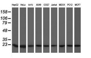Western blot analysis of extracts (35ug) from 9 different cell lines by using anti-VBP1 monoclonal antibody (HepG2: human; HeLa: human; SVT2: mouse; A549: human; COS7: monkey; Jurkat: human; MDCK: canine; PC12: rat; MCF7: human)