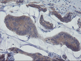 m08073 2 anti pfdn3 vbp1 mouse monoclonal antibody clone id oti2a3 ihc testing 4