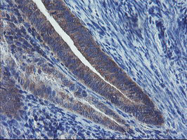 m08073 2 anti pfdn3 vbp1 mouse monoclonal antibody clone id oti2a3 ihc testing 5
