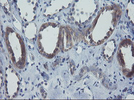 m08073 2 anti pfdn3 vbp1 mouse monoclonal antibody clone id oti2a3 ihc testing 7