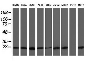 Western blot analysis of extracts (35ug) from 9 different cell lines by using anti-VBP1 monoclonal antibody (HepG2: human; HeLa: human; SVT2: mouse; A549: human; COS7: monkey; Jurkat: human; MDCK: canine; PC12: rat; MCF7: human)