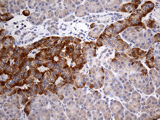 Immunohistochemical staining of paraffin-embedded Human pancreas tissue within the normal limits using anti-ATP6V0D2 mouse monoclonal antibody