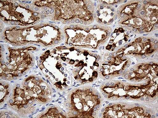 m08088 anti atp6v0d2 mouse monoclonal antibody clone id oti2d6 ihc testing 4