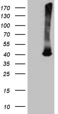 HEK293T cells were transfected with the pCMV6-ENTRY control (Left lane) or pCMV6-ENTRY ATP6V0D2 (Right lane) cDNA for 48 hrs and lysed
