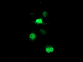 Anti-PSMB7 mouse monoclonal antibody (M08095-1) immunofluorescent staining of COS7 cells transiently transfected by pCMV6-ENTRY PSMB7