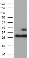 HEK293T cells were transfected with the pCMV6-ENTRY control (Left lane) or pCMV6-ENTRY PSMB7 (Right lane) cDNA for 48 hrs and lysed