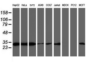 Western blot analysis of extracts (35ug) from 9 different cell lines by using anti-PSMB7 monoclonal antibody