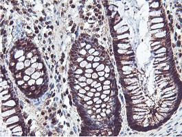 Immunohistochemical staining of paraffin-embedded Human colon tissue within the normal limits using anti-PSMB7 mouse monoclonal antibody