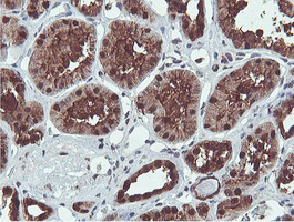 Immunohistochemical staining of paraffin-embedded Human Kidney tissue within the normal limits using anti-PSMB7 mouse monoclonal antibody