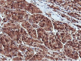 m08095 anti proteasome 20s beta 7 psmb7 mouse monoclonal antibody clone id oti1e1 ihc testing 14