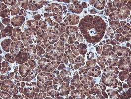 m08095 anti proteasome 20s beta 7 psmb7 mouse monoclonal antibody clone id oti1e1 ihc testing 3