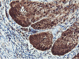 m08095 anti proteasome 20s beta 7 psmb7 mouse monoclonal antibody clone id oti1e1 ihc testing 4
