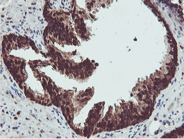 m08095 anti proteasome 20s beta 7 psmb7 mouse monoclonal antibody clone id oti1e1 ihc testing 5