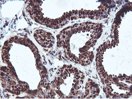 m08095 anti proteasome 20s beta 7 psmb7 mouse monoclonal antibody clone id oti1e1 ihc testing 6