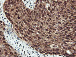 m08095 anti proteasome 20s beta 7 psmb7 mouse monoclonal antibody clone id oti1e1 ihc testing 7