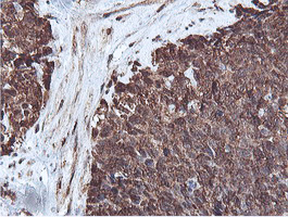 m08095 anti proteasome 20s beta 7 psmb7 mouse monoclonal antibody clone id oti1e1 ihc testing 9