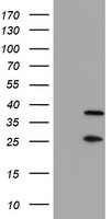 m08095 anti proteasome 20s beta 7 psmb7 mouse monoclonal antibody clone id oti1e1 wb testing 1