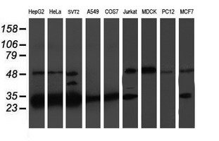 m08095 anti proteasome 20s beta 7 psmb7 mouse monoclonal antibody clone id oti1e1 wb testing 2