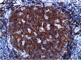 m08114 anti pik3ap1 mouse monoclonal antibody clone id oti7a11 ihc testing 2
