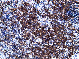 m08114 anti pik3ap1 mouse monoclonal antibody clone id oti7a11 ihc testing 3