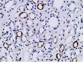 m08114 anti pik3ap1 mouse monoclonal antibody clone id oti7a11 ihc testing 4