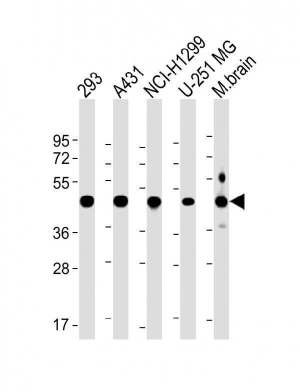 m08116 anti nsfl1c antibody center wb testing 1
