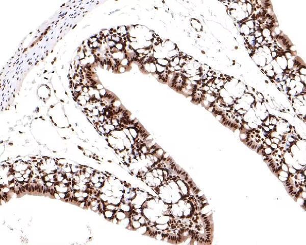 Immunohistochemical analysis of paraffin-embedded mouse large intestine tissue with TCEA1 antibody
