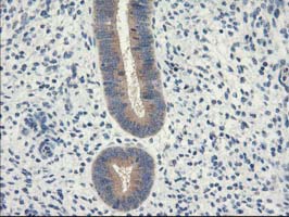 m08134 1 anti eif2b3 mouse monoclonal antibody clone id oti1a4 ihc testing 4
