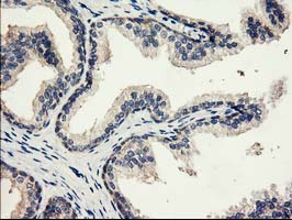 m08134 1 anti eif2b3 mouse monoclonal antibody clone id oti1a4 ihc testing 5