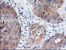 m08134 1 anti eif2b3 mouse monoclonal antibody clone id oti1a4 ihc testing 6