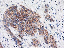 m08134 1 anti eif2b3 mouse monoclonal antibody clone id oti1a4 ihc testing 7