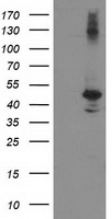 HEK293T cells were transfected with the pCMV6-ENTRY control (Left lane) or pCMV6-ENTRY EIF2B3 (Right lane) cDNA for 48 hrs and lysed
