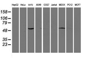 Western blot analysis of extracts (35ug) from 9 different cell lines by using anti-EIF2B3 monoclonal antibody
