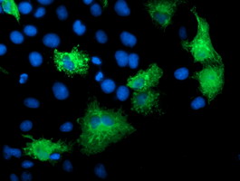 m08144 anti katanin p80 katnb1 mouse monoclonal antibody clone id oti5c4 if testing 5