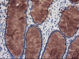 Immunohistochemical staining of paraffin-embedded Human colon tissue within the normal limits using anti-KATNB1 mouse monoclonal antibody