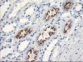 Immunohistochemical staining of paraffin-embedded Human Kidney tissue within the normal limits using anti-KATNB1 mouse monoclonal antibody