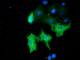 m08168 anti mtmr14 mouse monoclonal antibody clone id oti6b6 if testing 5