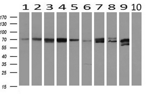 Western blot analysis of extracts (10ug) from 10 Human tissue by using anti-MTMR14 monoclonal antibody at 1:200 (1: Testis; 2: Omentum; 3: Uterus; 4: Breast; 5: Brain; 6: Liver; 7: Ovary; 8: Thyroid gland; 9: colon;10: spleen)
