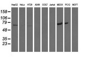 Western blot analysis of extracts (35ug) from 9 different cell lines by using anti-MTMR14 monoclonal antibody