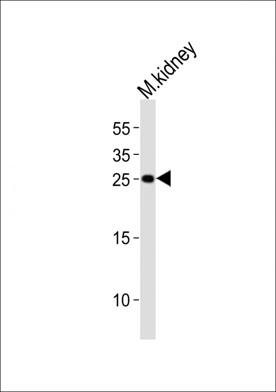 m08182 1 anti mouse cldn6 antibody c term wb testing 1