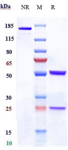 Anti-CLDN6 Reference Antibody (64A) on SDS-PAGE under reducing (R) condition