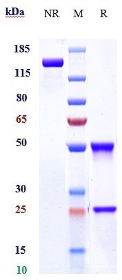 Anti-LY75/CD205/DEC-205 Reference Antibody (MEN1309) on SDS-PAGE under reducing (R) condition