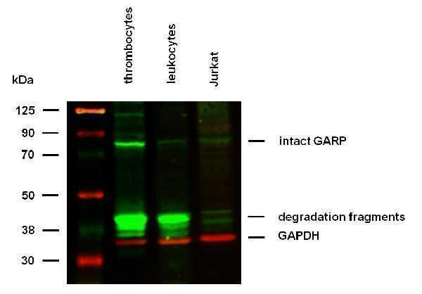 Anti-Hu GARP Purified (clone GARP5) works in WB application under reducing conditions