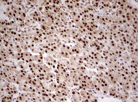 m08219 anti tipin mouse monoclonal antibody clone id oti2e6 ihc testing 2