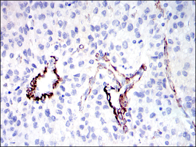 Immunofluorescence analysis of NIH/3T3 cells using SAPAP1 Monoclonal Antibody (green)